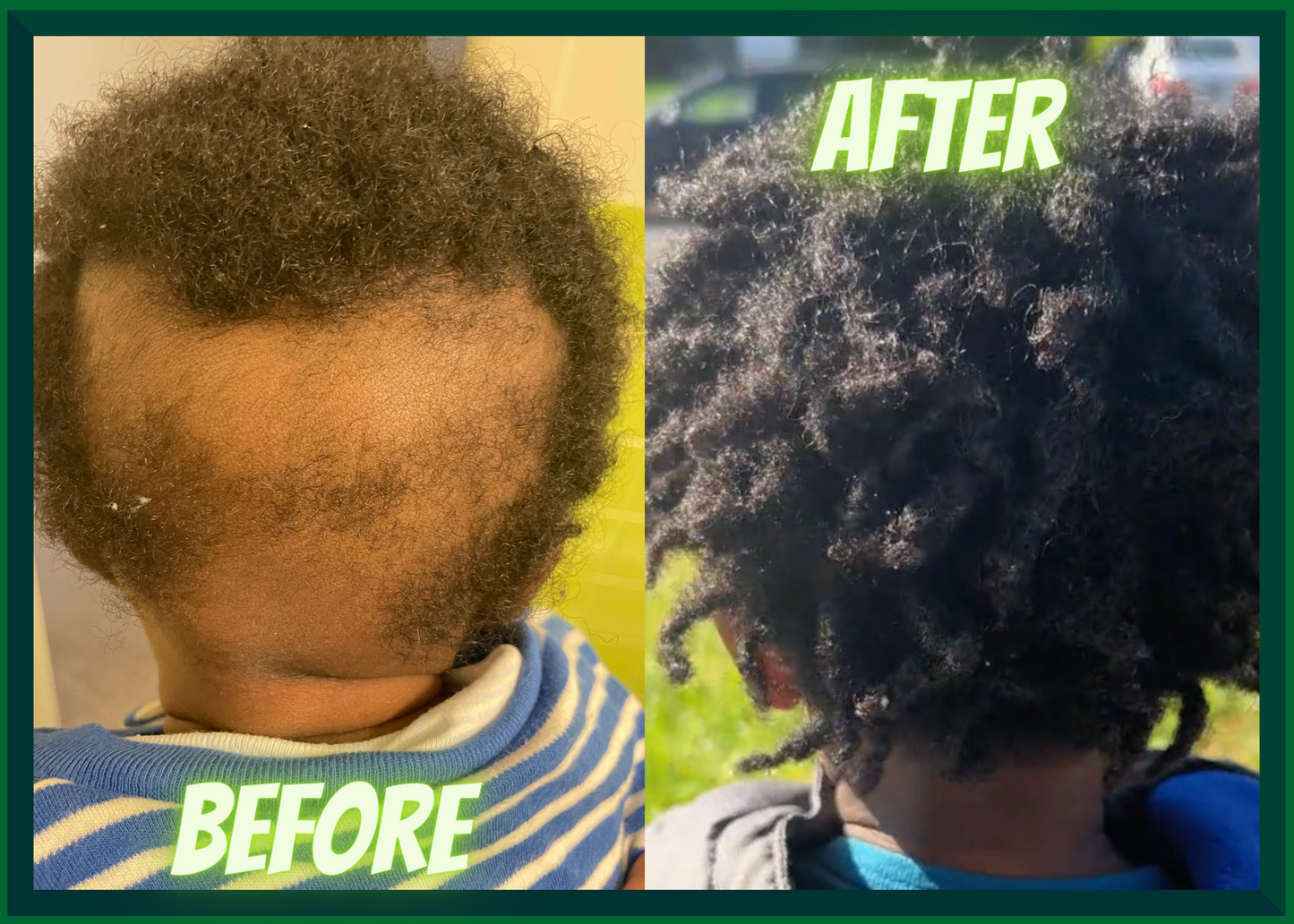 Baby Healing Hair & Skin Oil