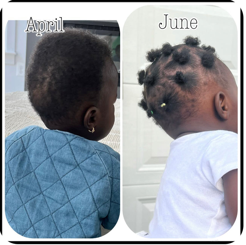 Baby Hair Growth Bundle