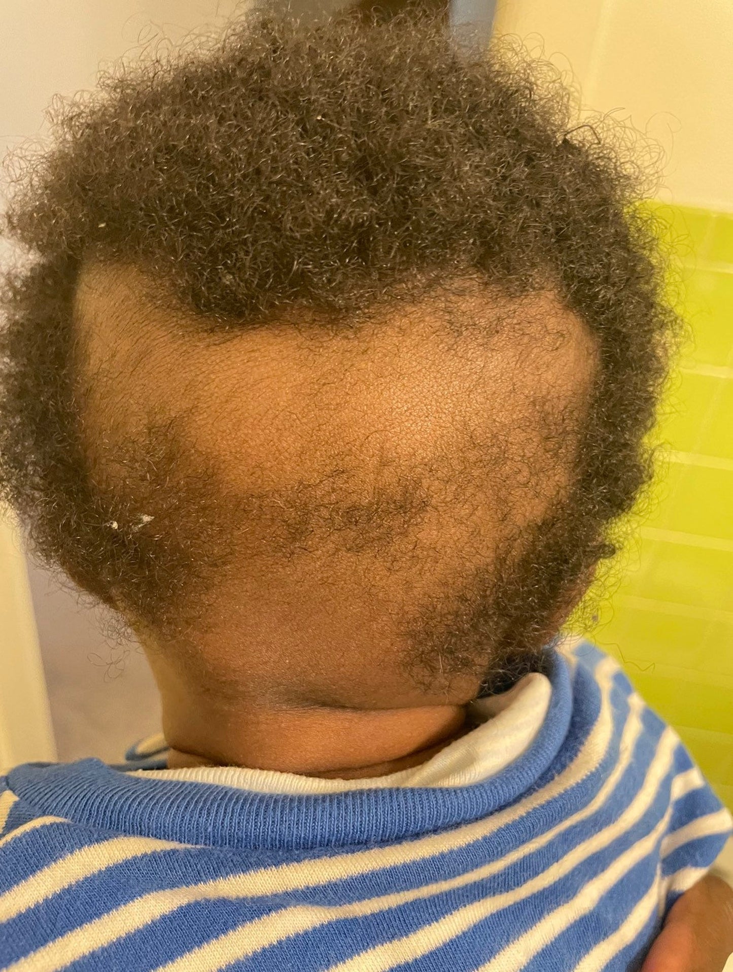 Baby Healing Hair & Skin Oil