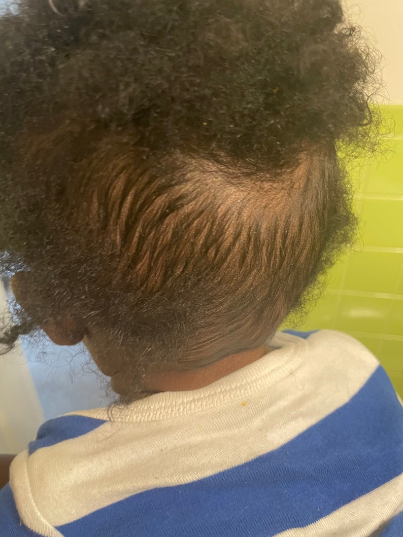 Baby Healing Hair & Skin Oil