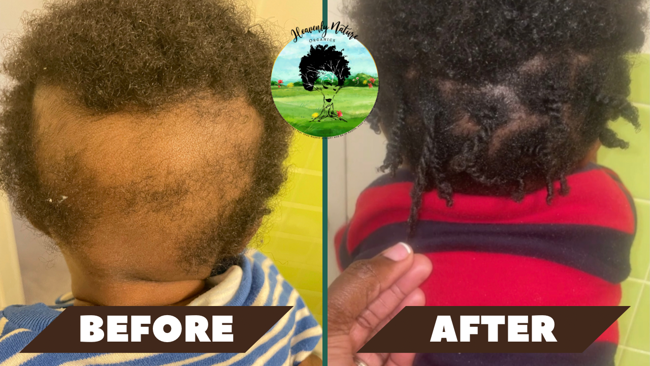 Baby Healing Hair & Skin Oil