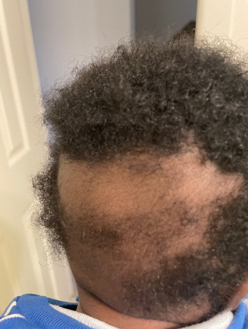 Baby Healing Hair & Skin Oil