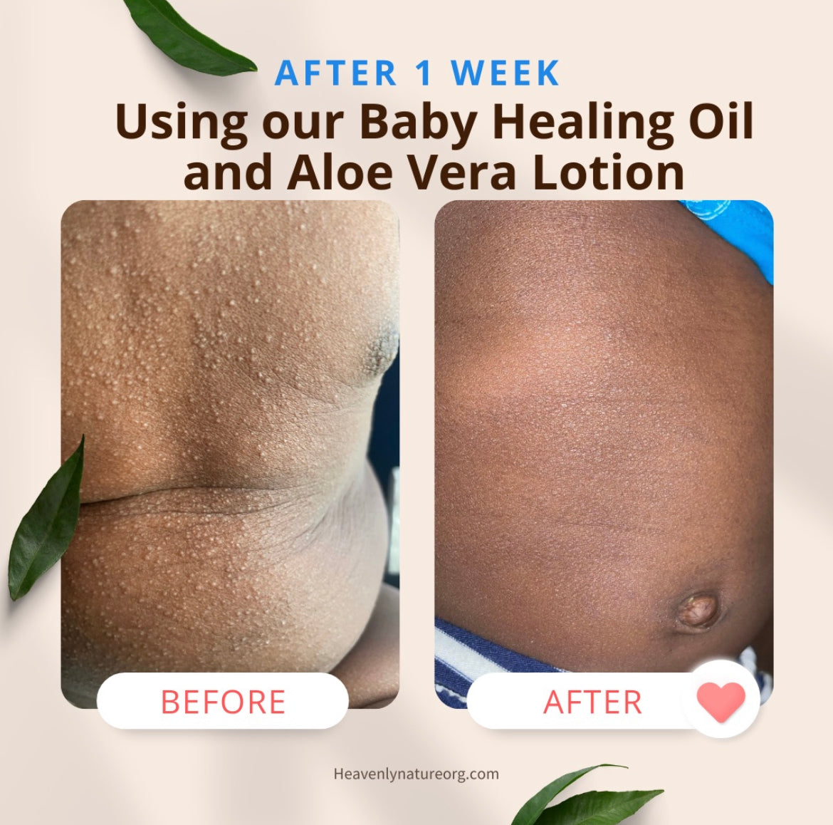 Aloe Vera Lotion/ Leave In