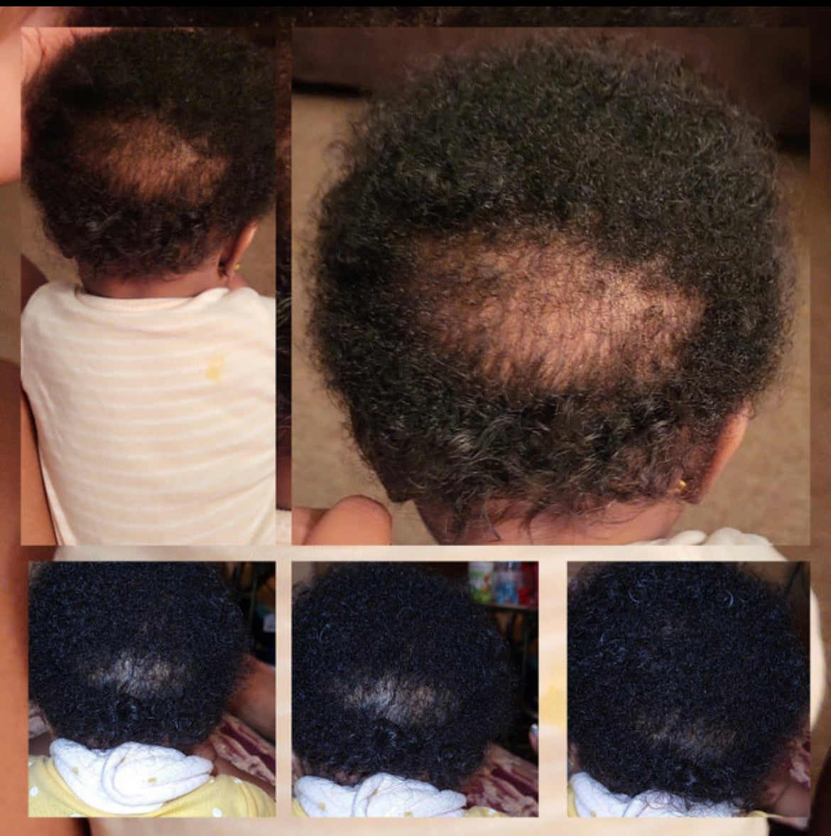 Baby Healing Hair & Skin Oil